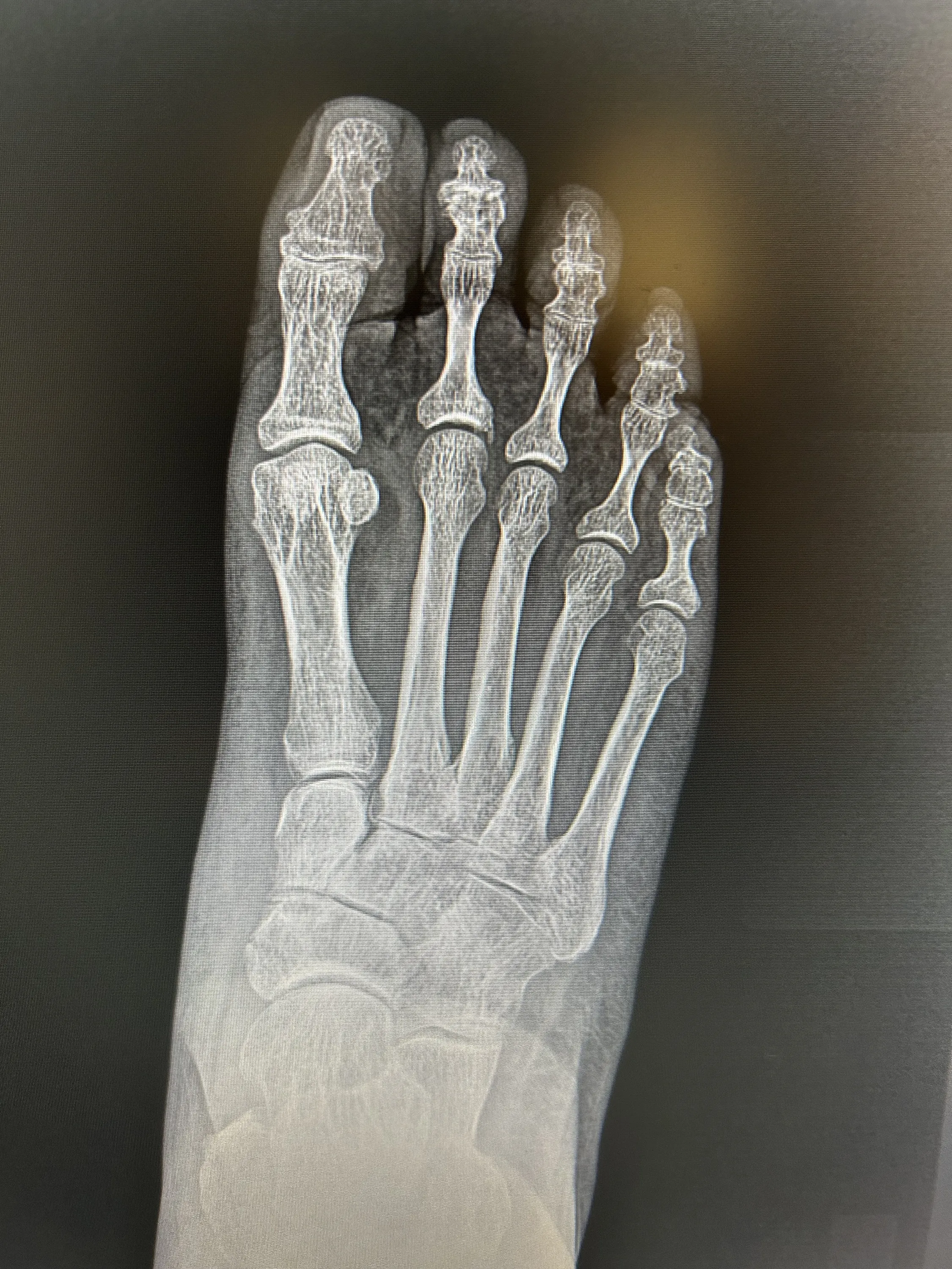 DIGITAL X-RAY