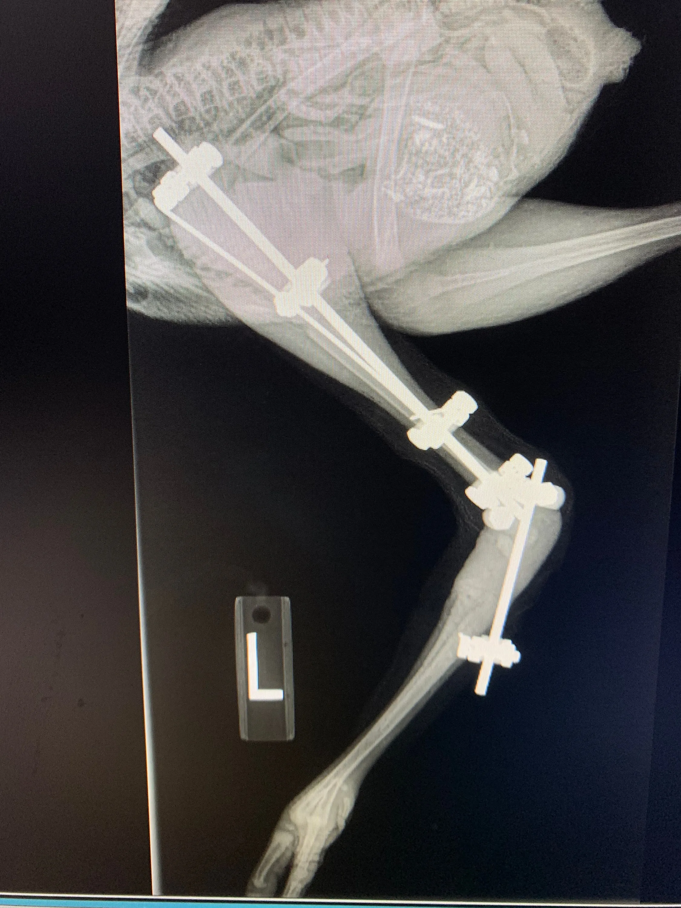 crane x ray
