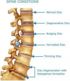 spine_conditions.jpg