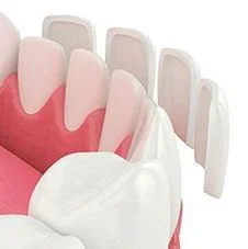 3D computer illustration of lower teeth with dental veneer shells floating in front of teeth, dental veneers Philadelphia, PA cosmetic dentistry