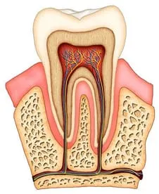 colored illustration of interior of molar tooth showing nerves, tissue, and root canal Salem, OR dentist