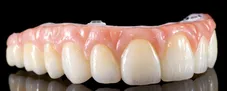 dental implant temporary bridge sunrise fl