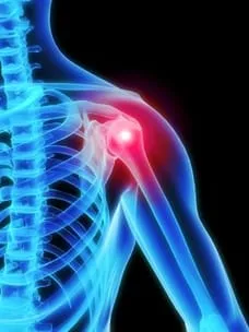 Illuminated model of shoulder joint pain