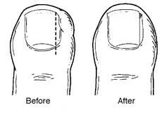 before and after treatment