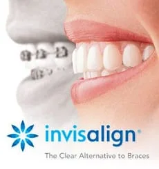 Invisalign logo and side by side images of mouth wearing braces next to mouth wearing Invisalign Burlington, NC