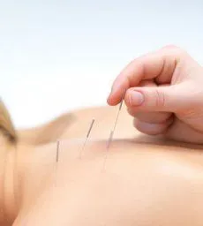 Serenity Health Wellness Acupuncture Chiropractor in Edmonton