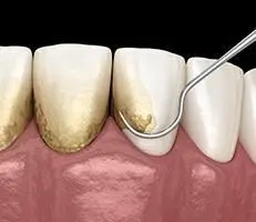 periodontics