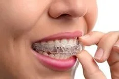 woman holding clear teeth aligners in mouth Invisalign Brooklyn, NY