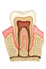 illustration of inside of tooth showing root canals, Lake Worth, FL And Greenacres, FL dentist