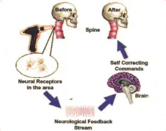 Arthrostim effects