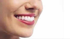 Invisalign