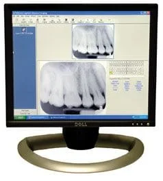 Low Radiation Dental X-rays Fullerton CA