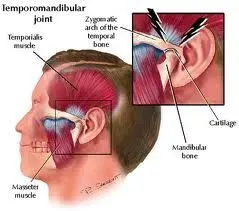 tmj therapy