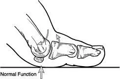 Normal function of the joint at the base of the big toe