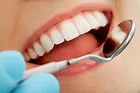 dental mirror near woman's open mouth reflecting nice white teeth, tooth bonding Fresno, CA dentist