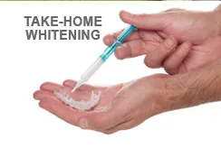 Teeth Whitening Options.