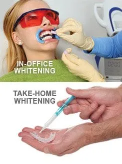 woman getting teeth whitening treatment Fond du Lac, WI dentist