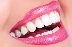 teeth whitening