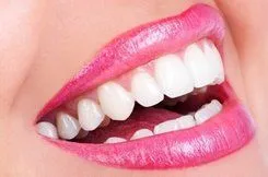 close up of woman's mouth with white teeth and pink lipstick, teeth whitening Lake Stevens WA