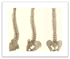 spinal_disc.png