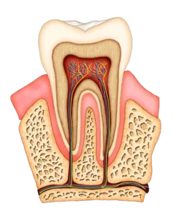 Root Canal Westminster