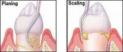 Scaling