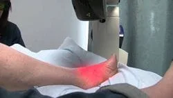 Laser-on-Foot