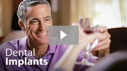 Dental implant video