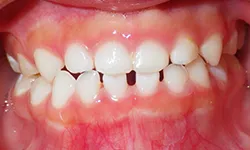 smile