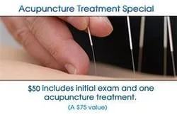 acupuncture1.jpg