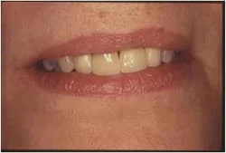Pittsburgh periodontist picture of Smile