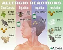 allergy_rxns.jpg