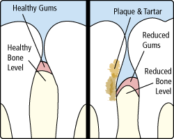 periodontics
