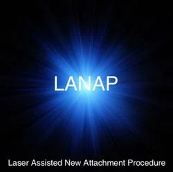 LANAP & Laser Gum Surgery