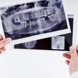 Dental X-rays