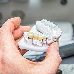 hand holding mold of mouth with dental crowns on teeth