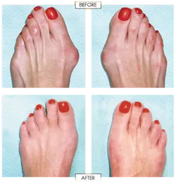 Getting a Pedicure? Here Are Some Things To Know Before You Go: Premier Foot  and Ankle Center & Elite Upper Extremity and Plastic Surgery: Podiatry