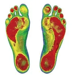 High-tech foot scans