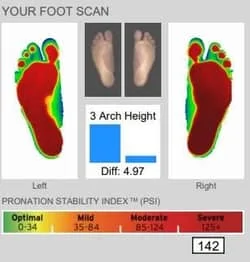 foot scan up-close