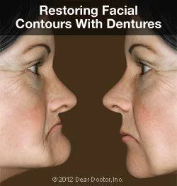 Dentures New Port Richey, FL