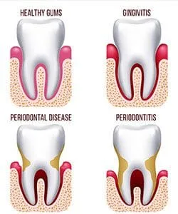 periodontal-treatments-pic.jpg