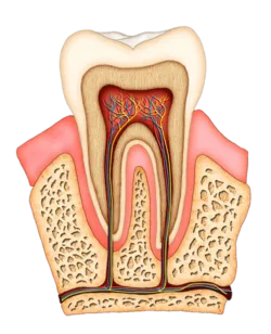 Root Canal Scarborough