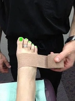 5th Toe Fracture Splinting Technique