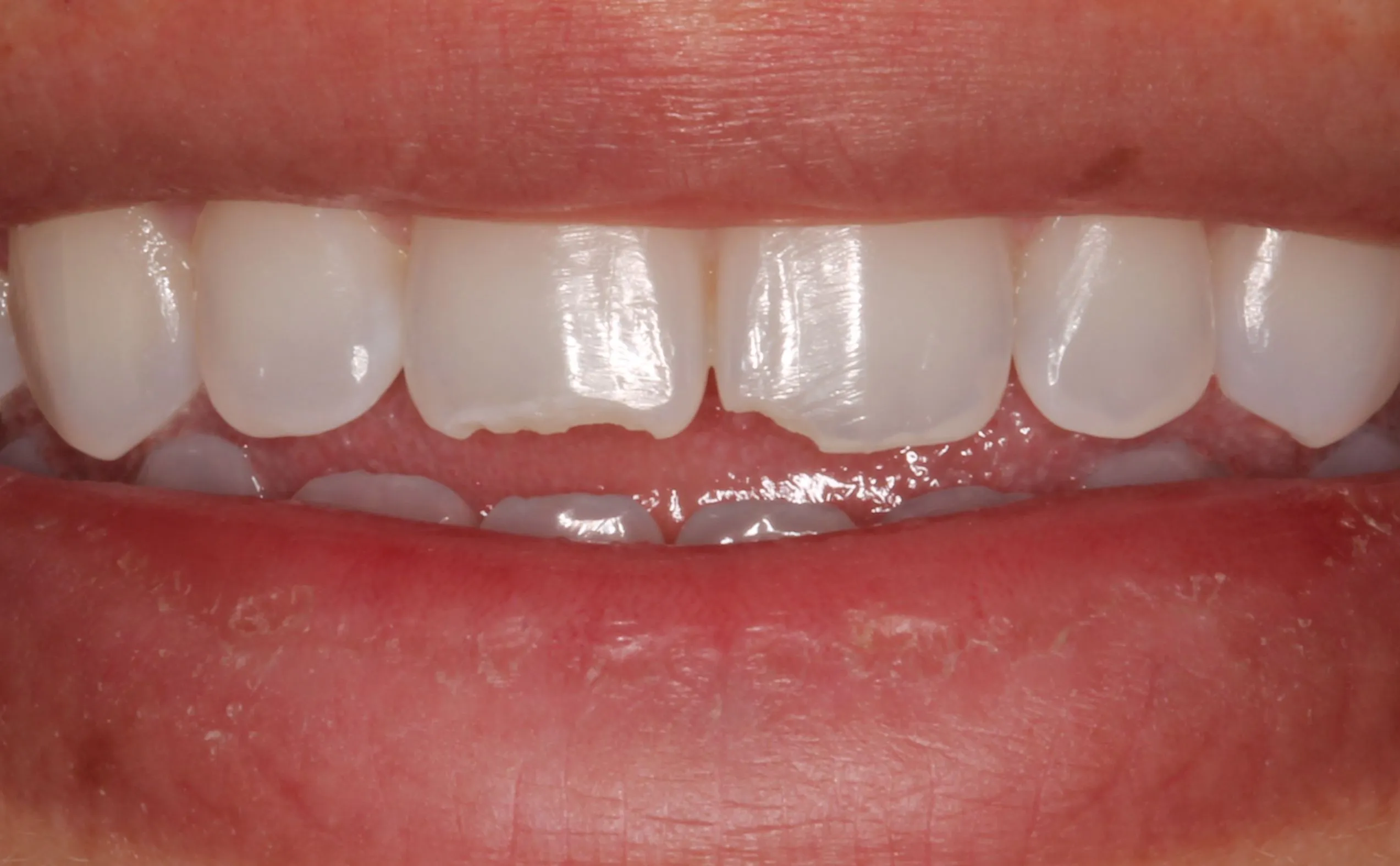 Timeless Smile | Smile Gallery in North Austin