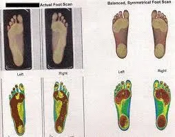 scan_of_foot.jpg