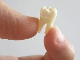 close up of thumb and forefinger holding extracted tooth by roots, tooth extractions Newark, CA family dentistry