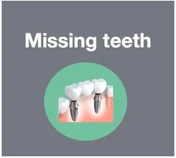 Replace missing teeth with implants