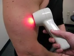 Cold laser therapy