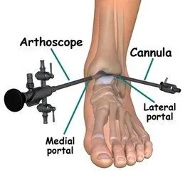 San Diego Podiatrist | San Diego Ankle Surgery | CA | San Diego Podiatry Group |