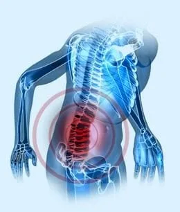 hernated disc treatment NYC, Soho Noho downtown New York City chiropractor and physical therapist for back pain